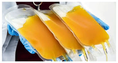 LyoPlasm Universal AB Product